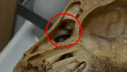 男子吃完外卖发现羊头骨里全是蛆，恶心一整夜，法院判了