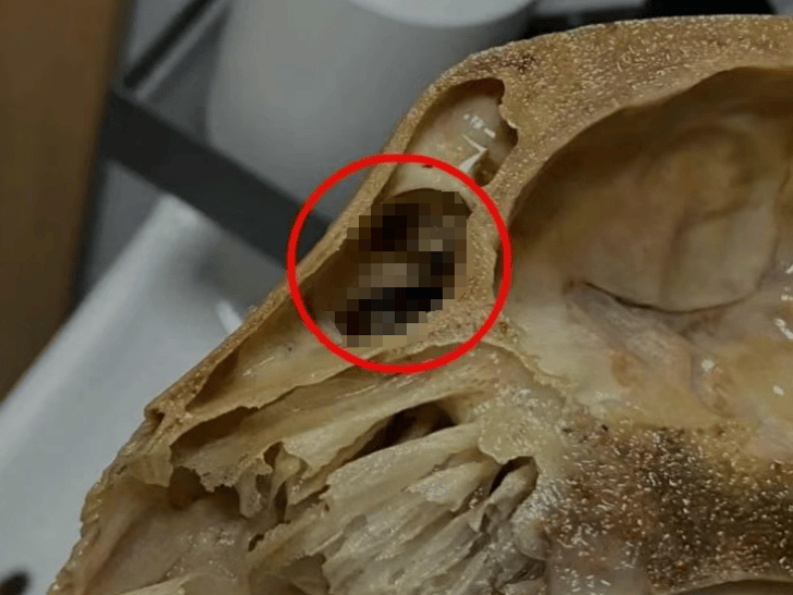 男子吃完外卖发现羊头骨里全是蛆,恶心一整夜,法院判了